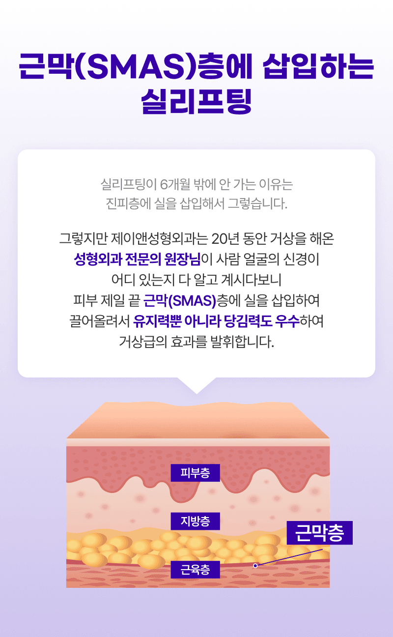 四向提拉:僅用一條線即可提拉四次。 6