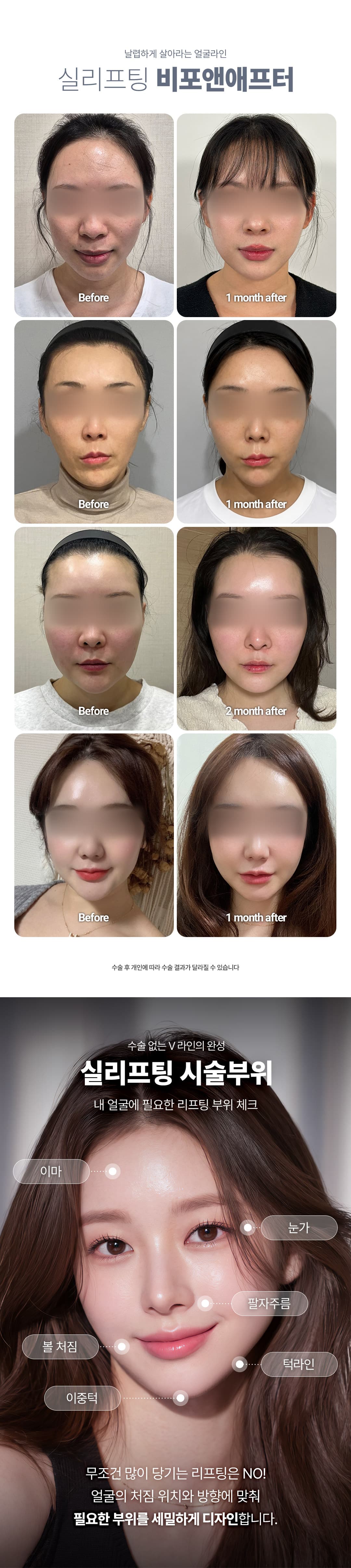 Ерөнхий захирал_DM Thread Lifting 2