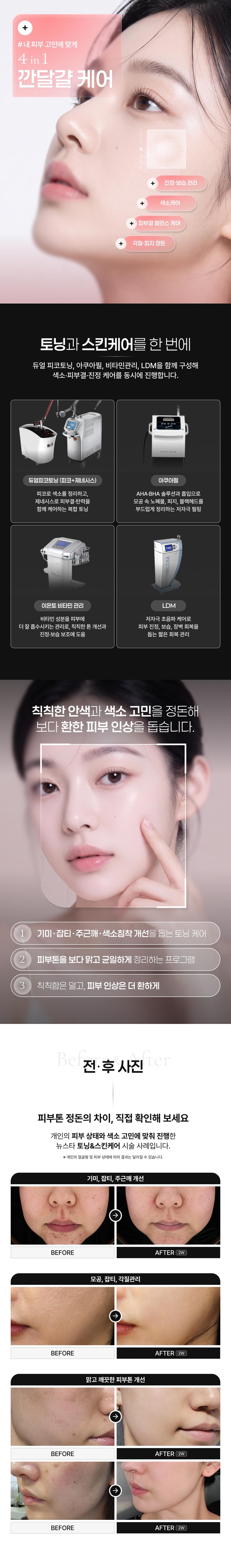 토닝&스킨케어 첫방문 이벤트 2