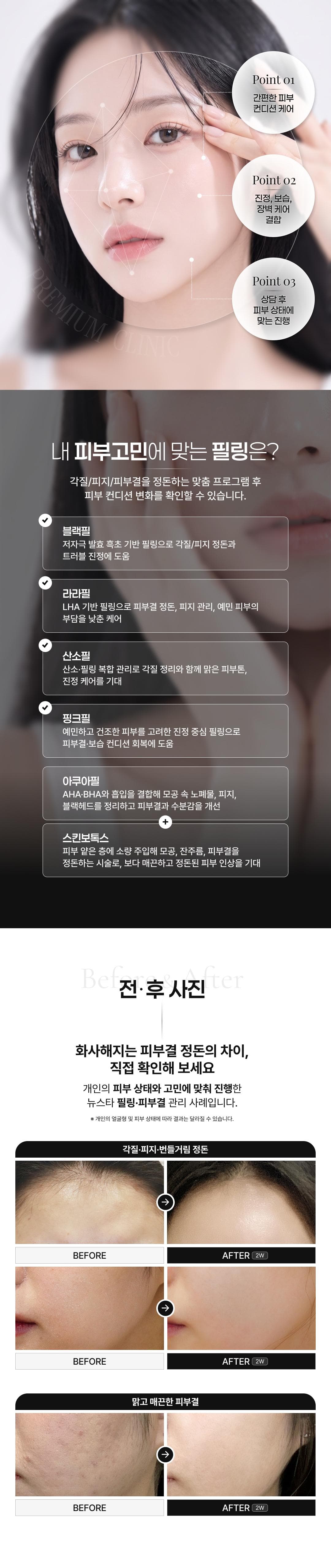 피부결 집중관리 필링 첫방문 이벤트 2