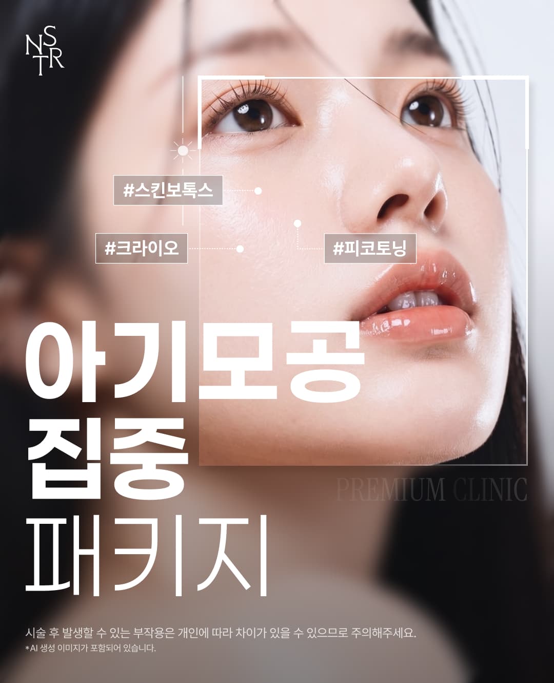 코,나비존 집중관리 아기모공 이벤트 1