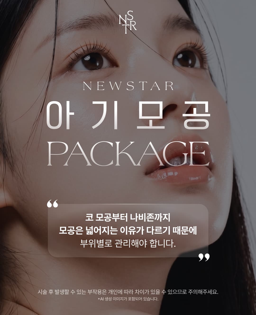코,나비존 집중관리 아기모공 이벤트 2