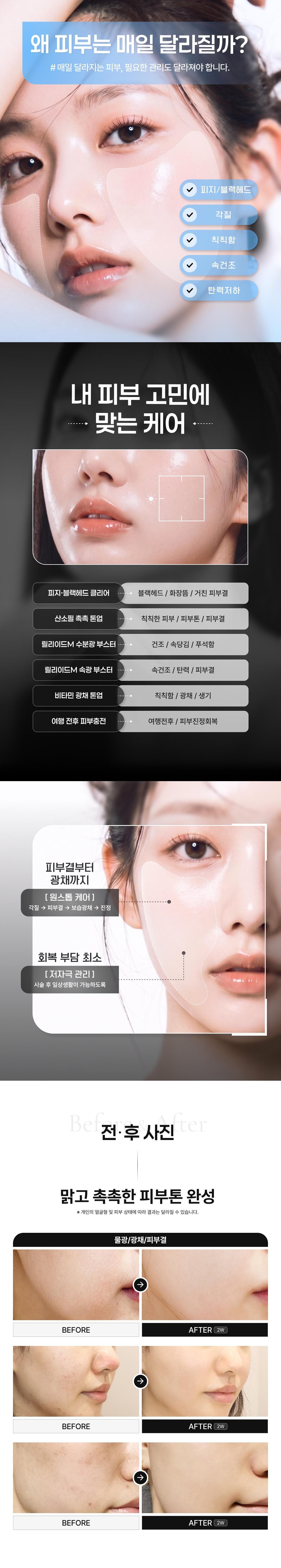 필링·크라이오·스킨부스터 맞춤 물광 피부관리 이벤트 4