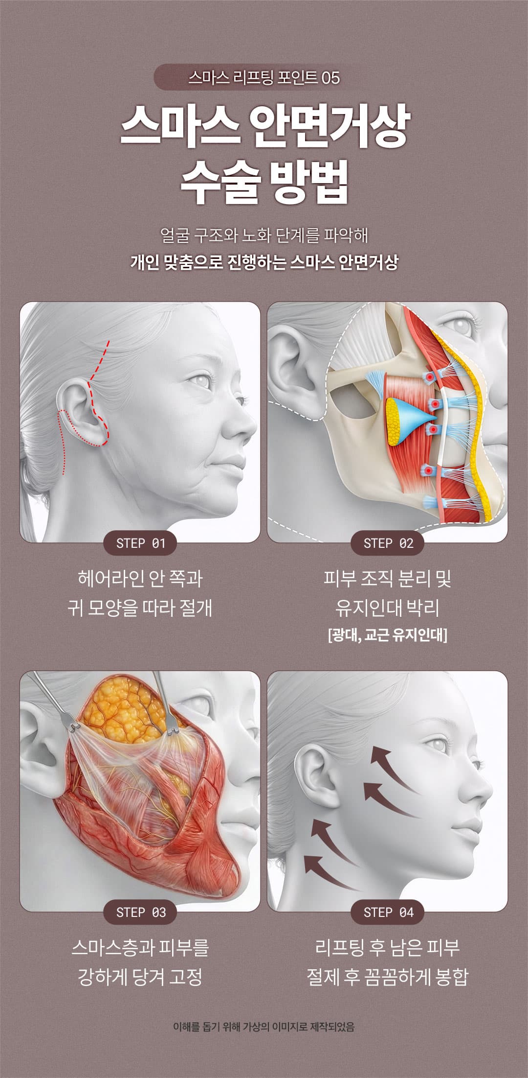 Ketua Pengarah_SMAS Facelift_Termasuk Leher Lift 7
