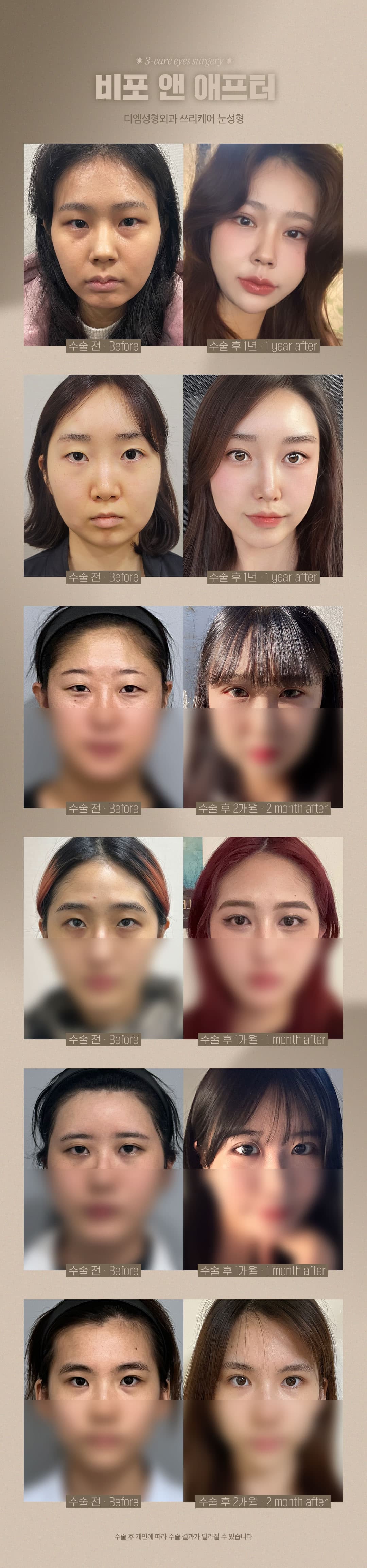 DM Three Care Augenchirurgie 3