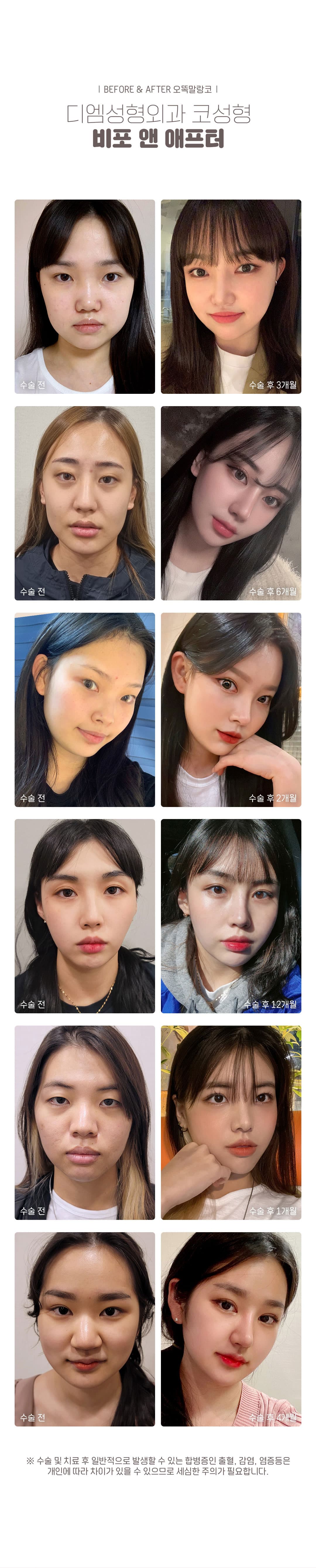 DM Ottok Mallangko 2