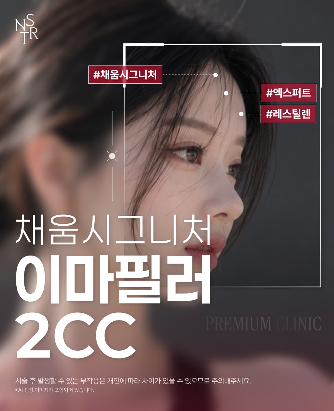 뉴스타 이마필러, 미간보톡스, 관자필러 1
