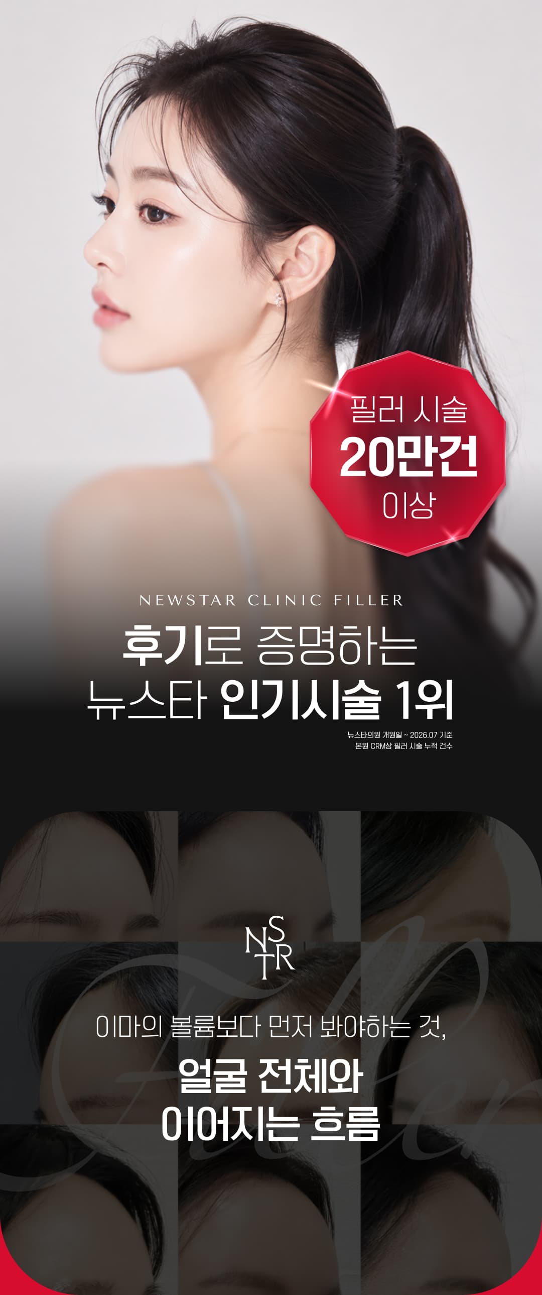뉴스타 이마필러, 미간보톡스, 관자필러 4