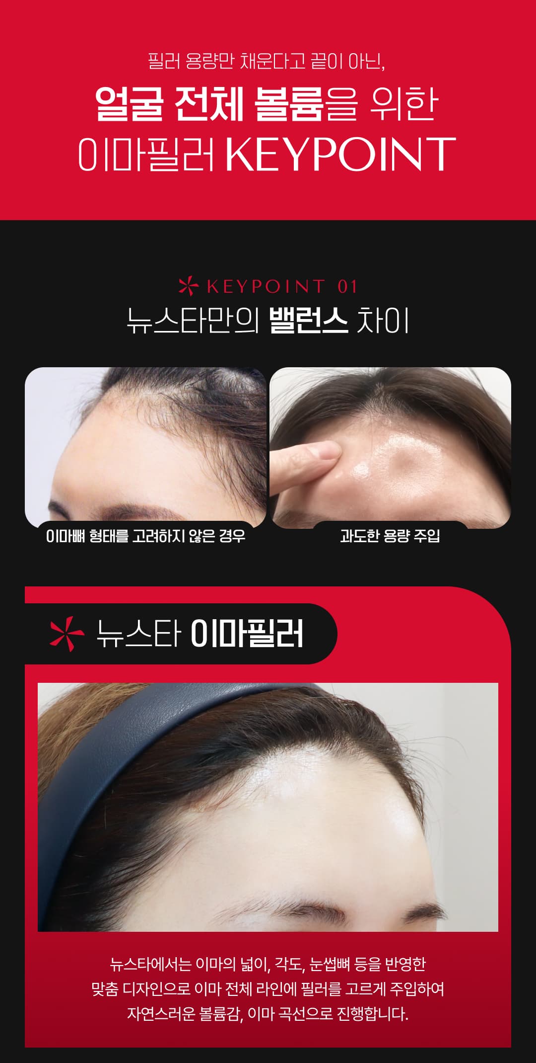 뉴스타 이마필러, 미간보톡스, 관자필러 5