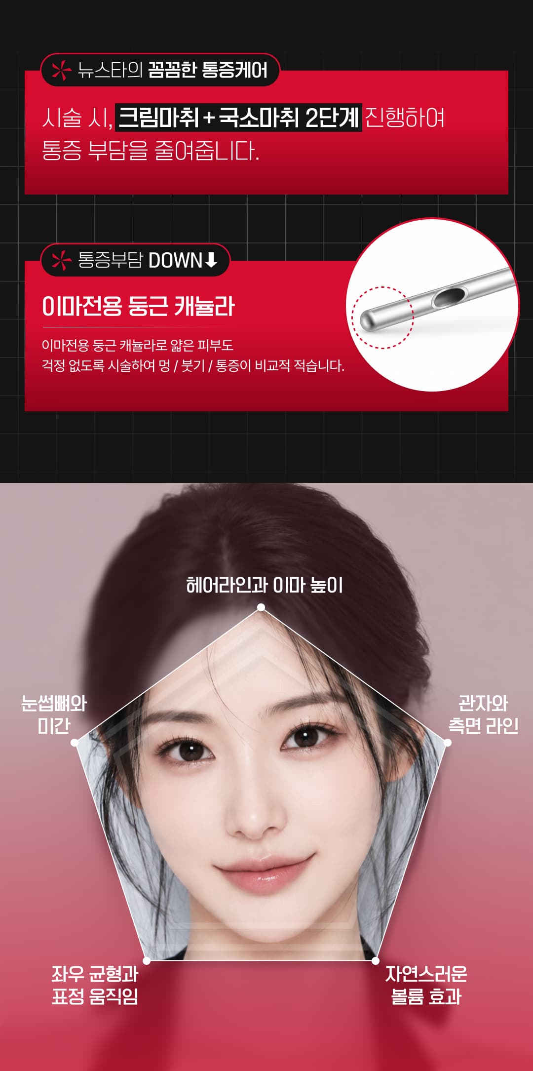 뉴스타 이마필러, 미간보톡스, 관자필러 7