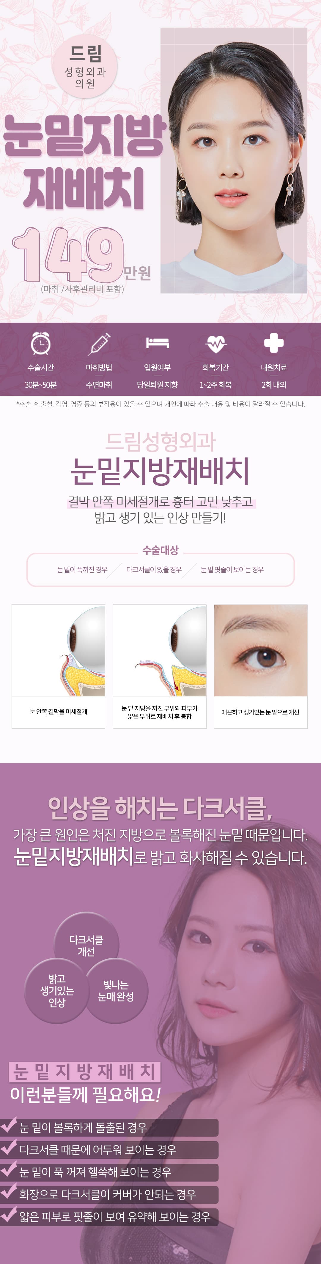 드림 눈밑지방재배치 1