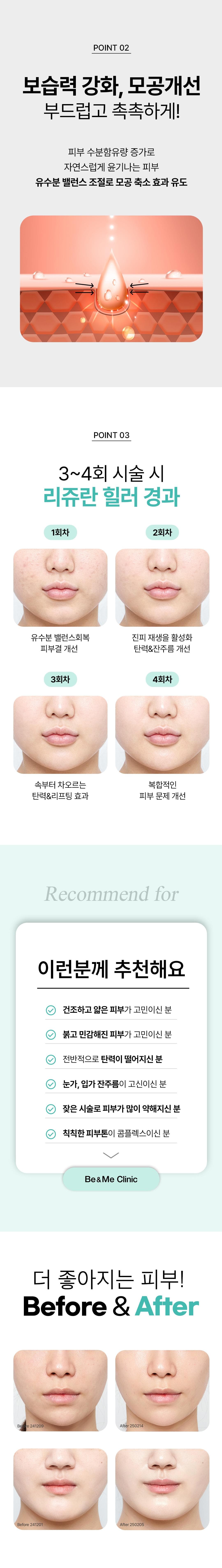 비앤미 물광피부, 광채리쥬란힐러2CC 2