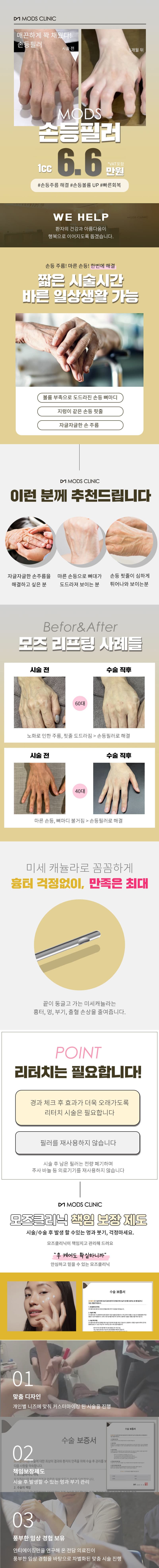 Cheongdam Modz-н онцгой мэдрэмтгий гар дүүргэгч - Гарын үрчлээг арилгаж, гарны хэмжээг нэмэгдүүлнэ 1