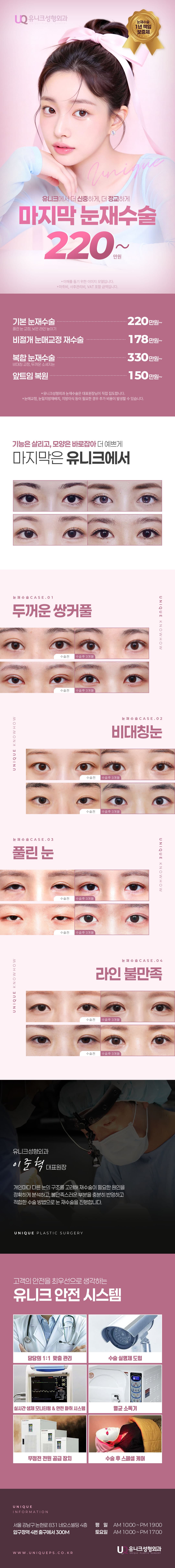 마지막 눈재수술_매몰 절개 눈매교정 트임 쌍꺼풀 눈밑지방재배치 앞트임복원 1