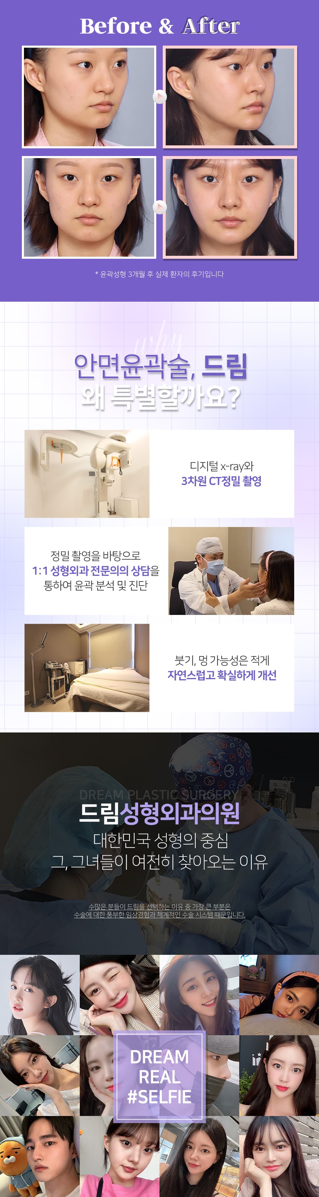 드림 안면윤곽 윤곽3종 2