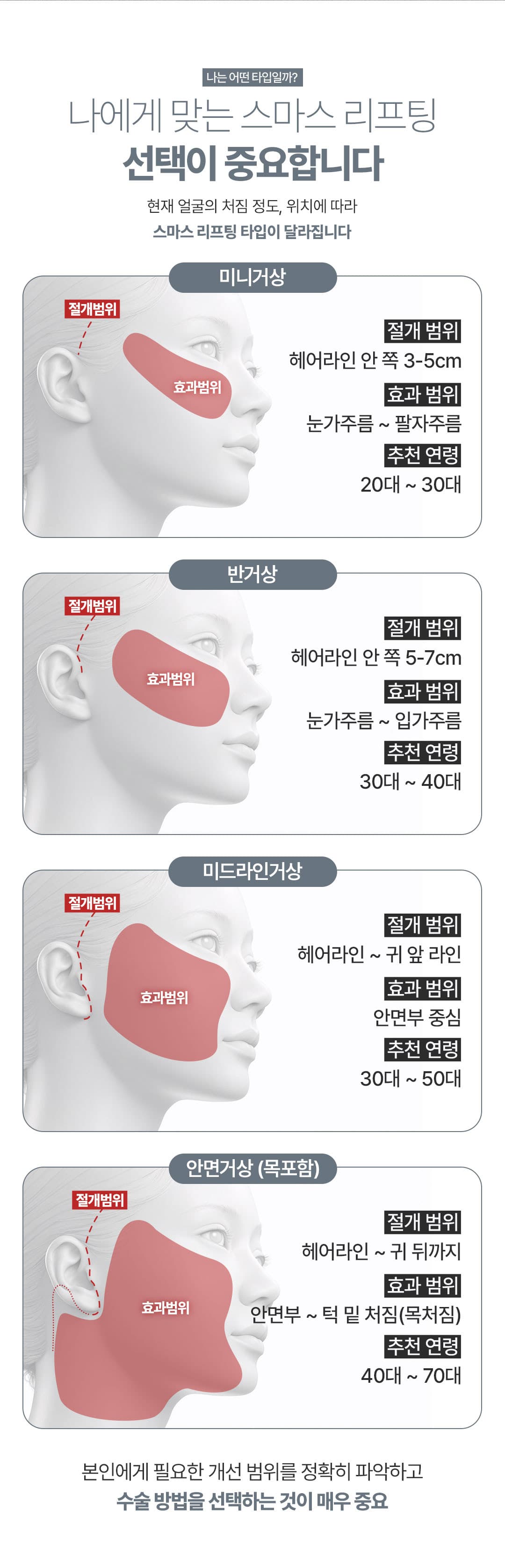 Director General_SMAS Mini Lifting, Semilifting, Lifting de línea media, Lifting facial 2