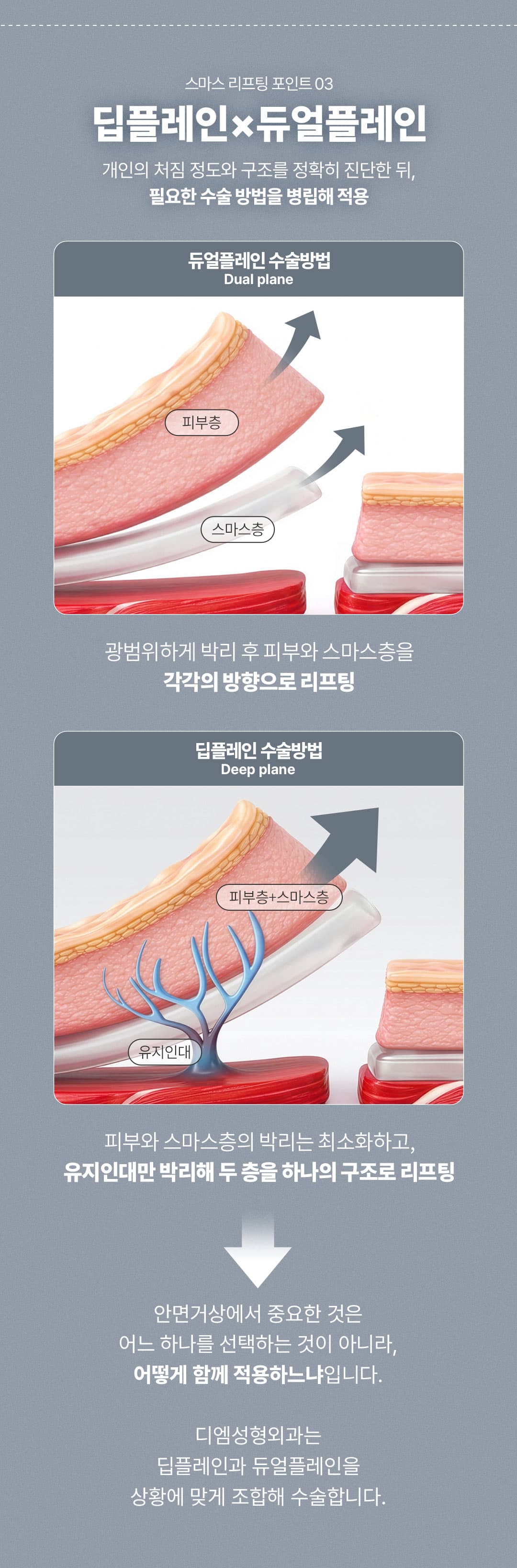 Director General_SMAS Mini Lifting, Semilifting, Lifting de línea media, Lifting facial 5