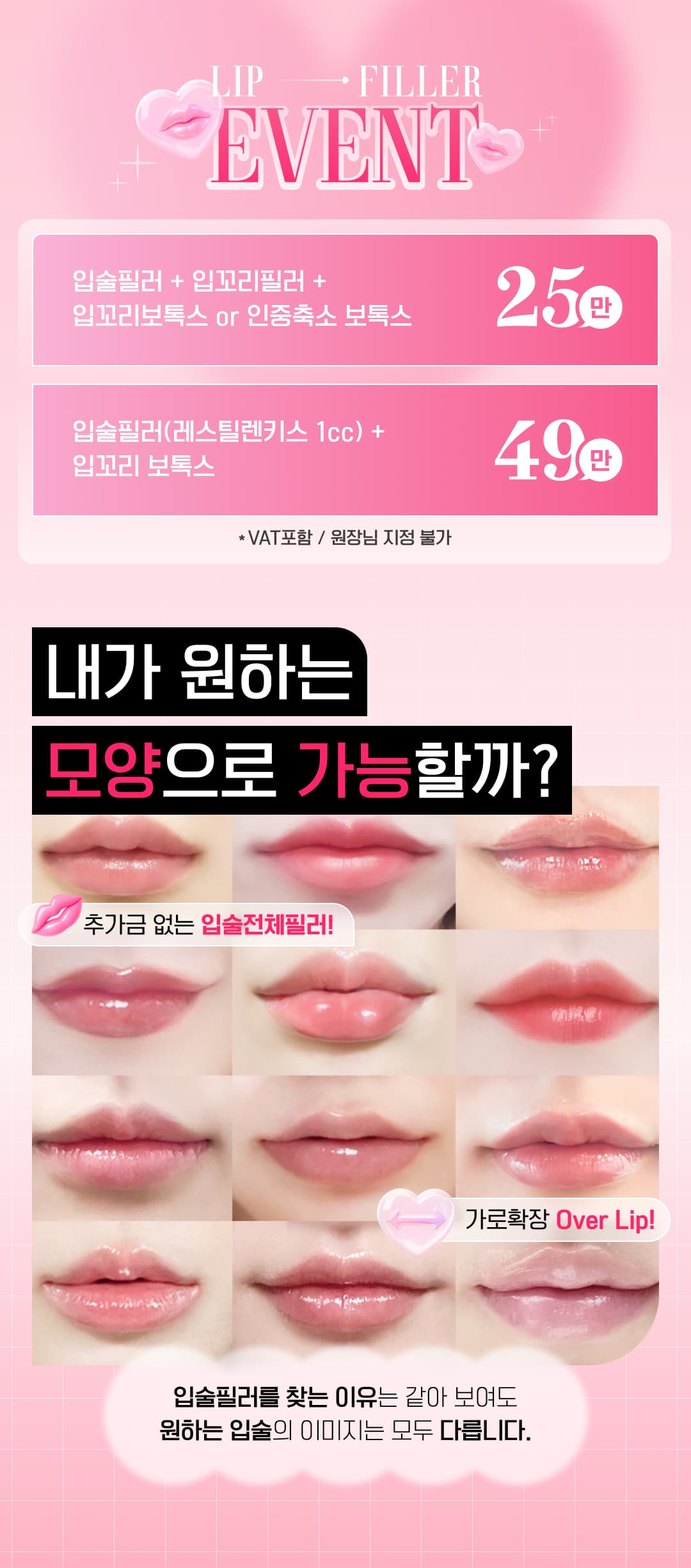 Newstar Lippenfiller, Mundwinkelfiller, Botox für die Mundwinkel, Botox zur Philtrumreduktion 3