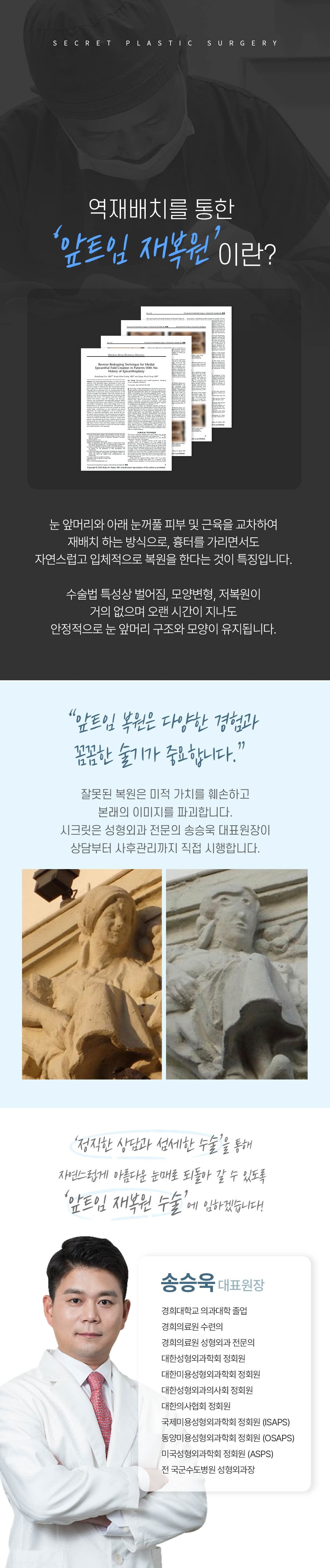 시크릿 앞트임 재복원 2
