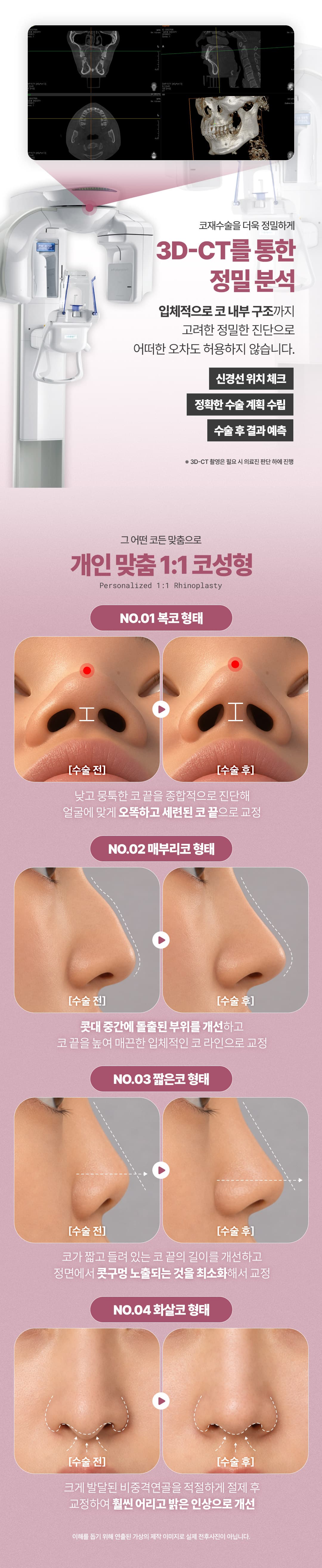 Leitender Direktor_DM Rhinoplastik 3