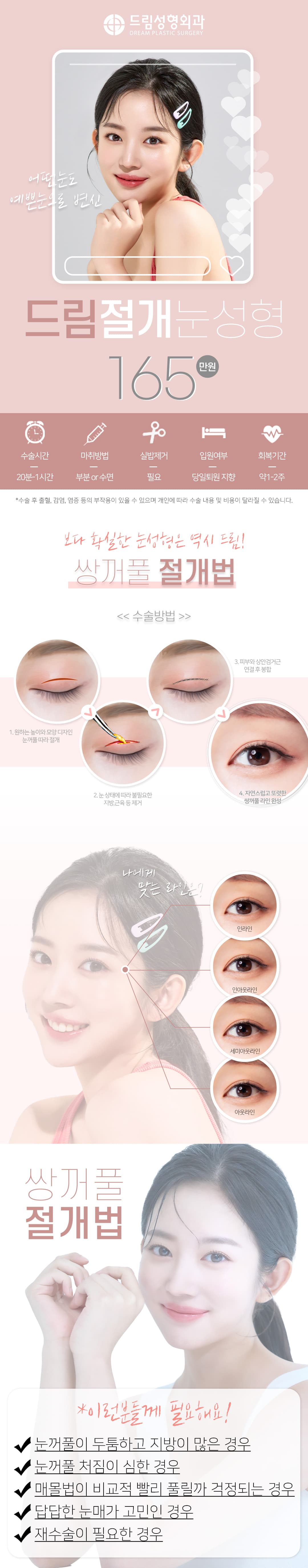 드림 절개 쌍꺼풀 1