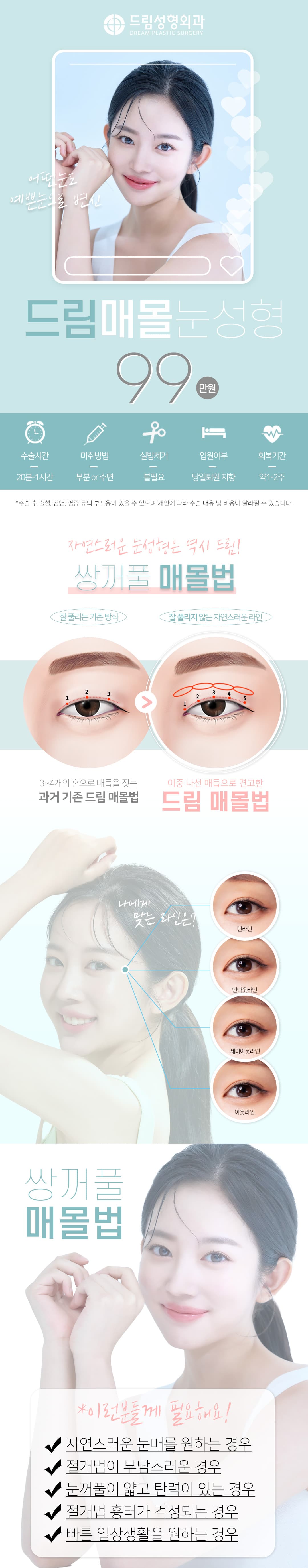 드림 매몰 쌍꺼풀 1