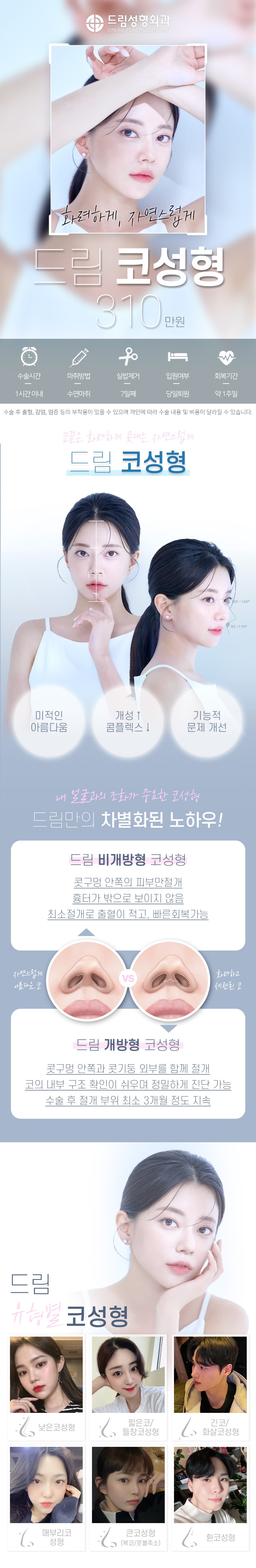 드림 코성형 유형별 맞춤코성형 1