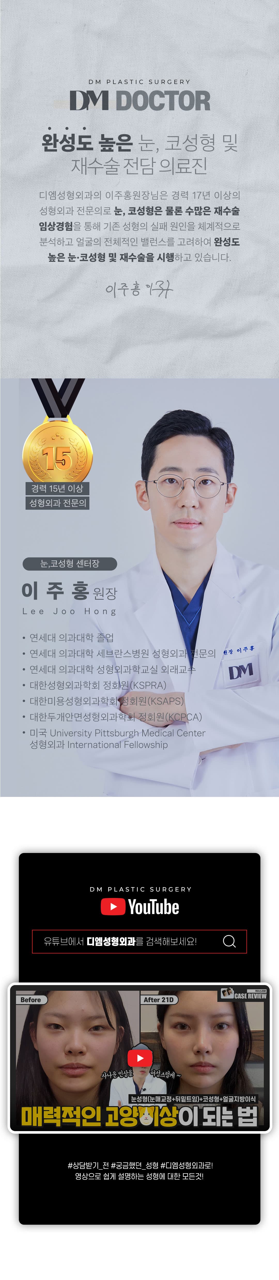 DM-Rhinoplastik-Revision 5