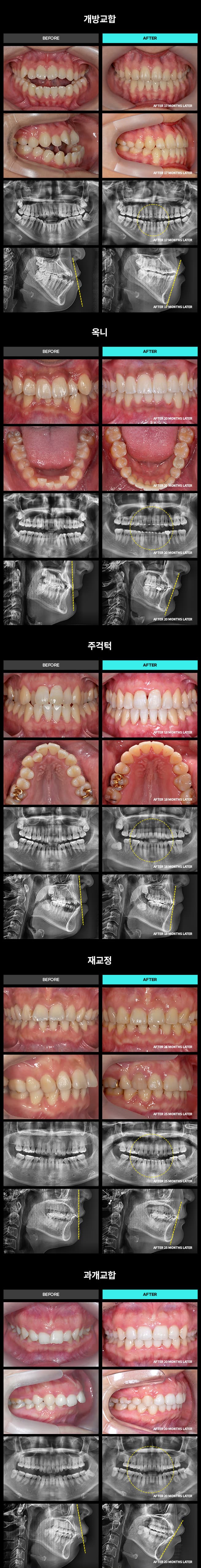 Pagamento parcelado disponível para o tratamento com Invisalign baseado na Proporção Áurea. 2