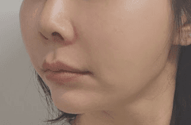 강남역써마지 잘하는곳 찾은 나 칭찬해~! 1