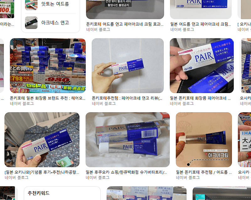 돈키호테 여드름 연고 써봤는데 솔직 후기예요 1