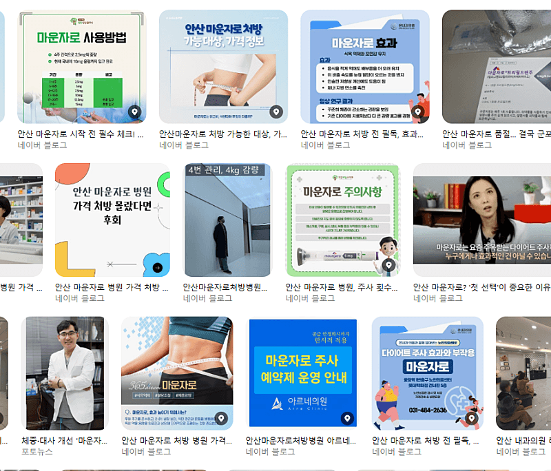 안산 마운자로 써보신 분? 1