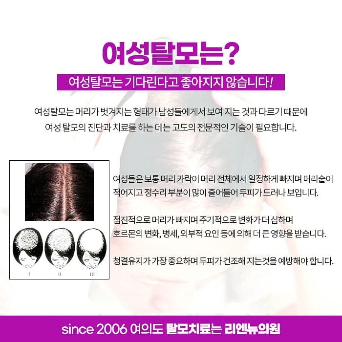 영등포 탈모 치료를 더늦기전에 3