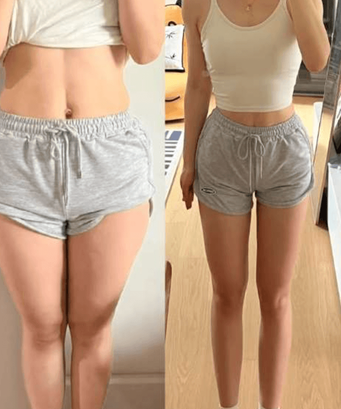 한달 7kg 빠지니까 주변 반응 달라지더라고요 2