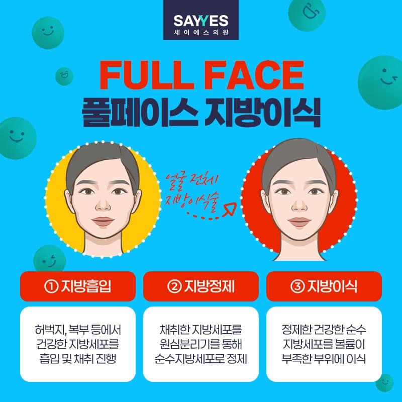이마지방이식 관자놀이, 눈밑 포함한 얼굴지방이식후기 전체 80만원대로 가능 3