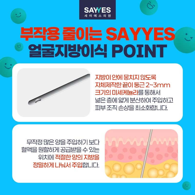 이마지방이식 관자놀이, 눈밑 포함한 얼굴지방이식후기 전체 80만원대로 가능 6