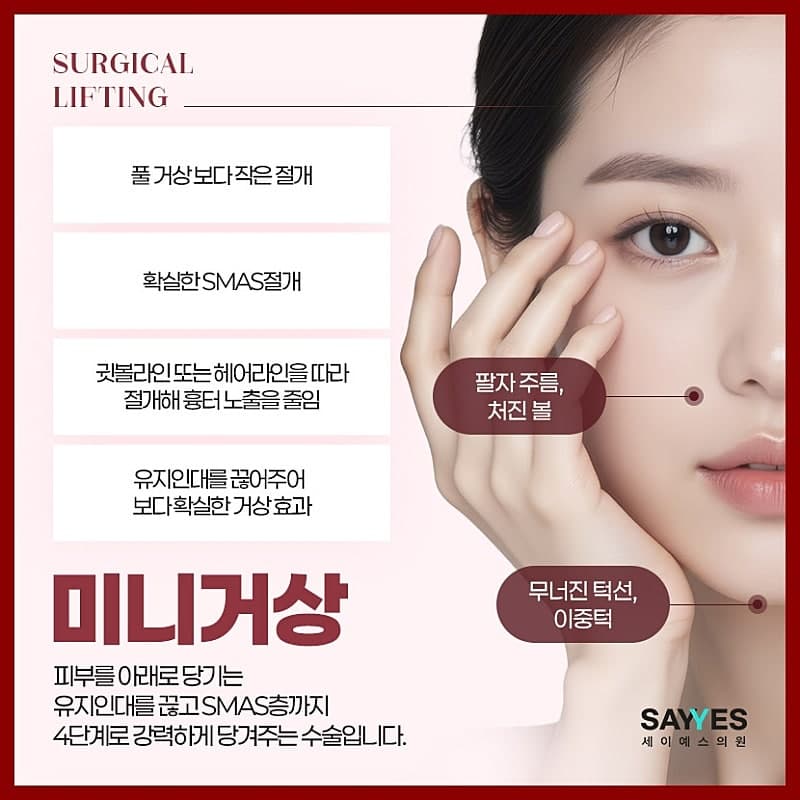 턱라인리프팅 브이라인 안면거상술비용 낮춘 미니거상가격 3