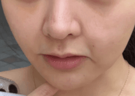 순천피부관리 잘하는 곳 알려주세요! 1