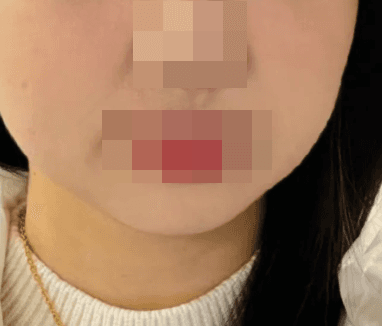 울산피부관리 진짜 잘하는 곳 찾아요 1
