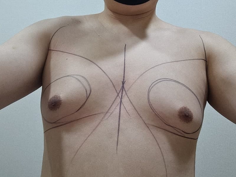 벌써 반팔 쇼핑 중입니다 ㅋㅋㅋ 여유증수술 후 인생이 바뀌었네요 1