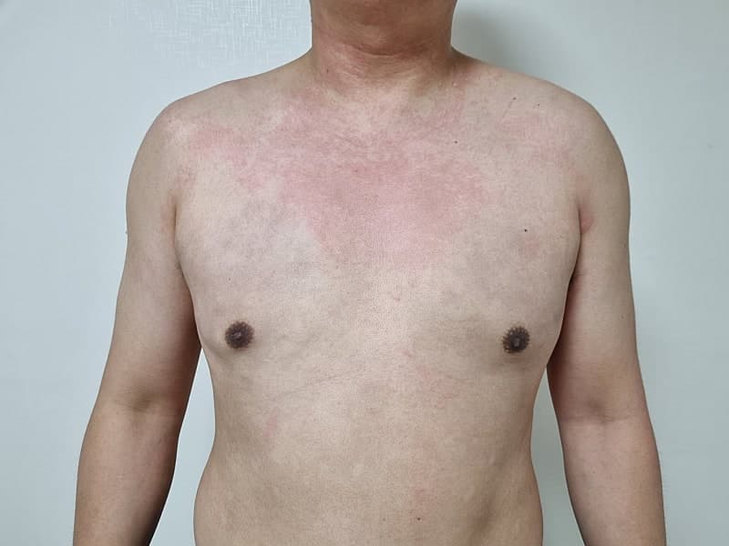 벌써 반팔 쇼핑 중입니다 ㅋㅋㅋ 여유증수술 후 인생이 바뀌었네요 2