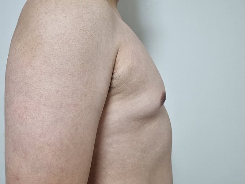 벌써 반팔 쇼핑 중입니다 ㅋㅋㅋ 여유증수술 후 인생이 바뀌었네요 3