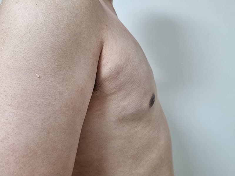 벌써 반팔 쇼핑 중입니다 ㅋㅋㅋ 여유증수술 후 인생이 바뀌었네요 4