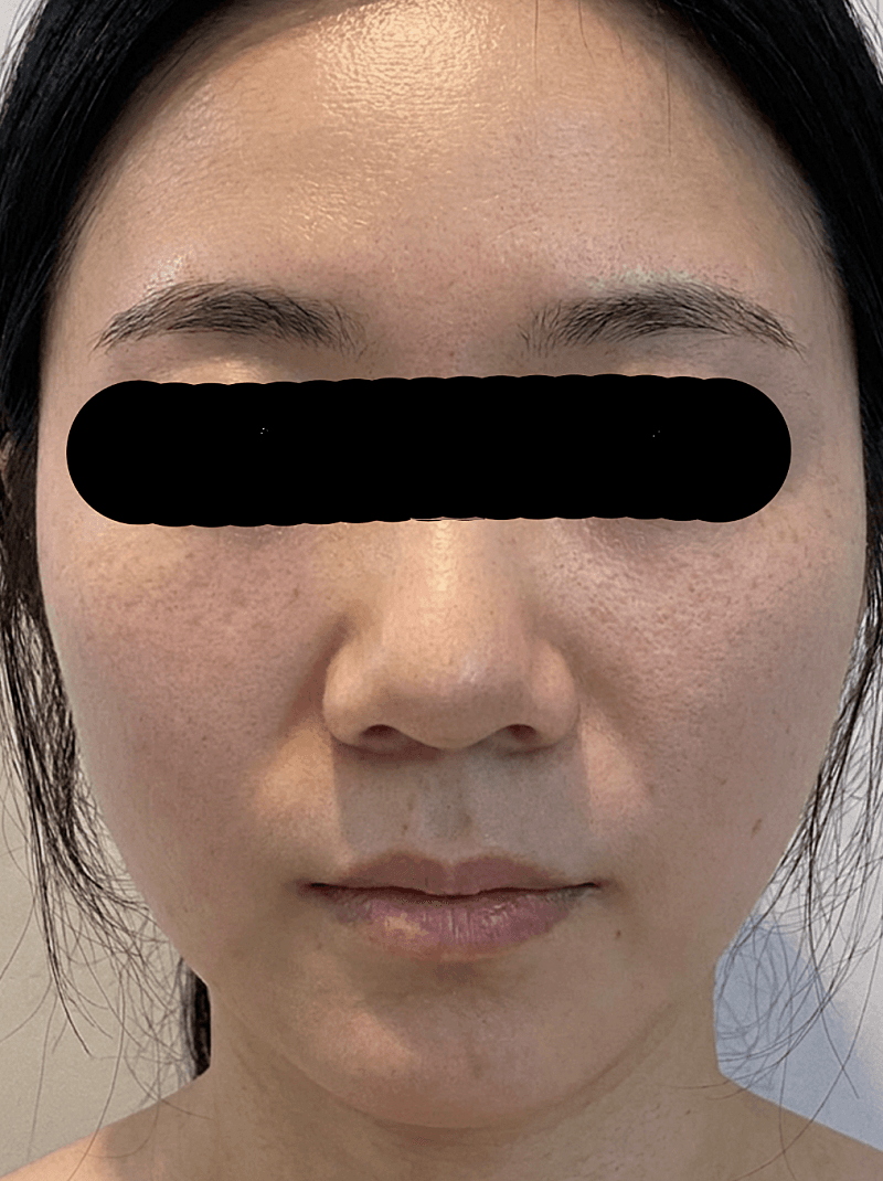 광주쥬베룩볼륨 화장 끼임 신경 쓰여서 받아봤어요! 5