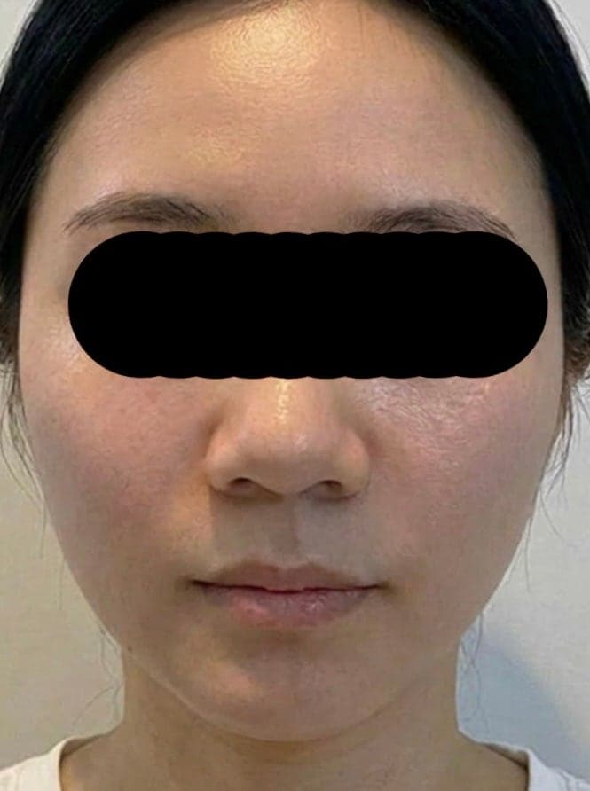 광주쥬베룩볼륨 화장 끼임 신경 쓰여서 받아봤어요! 6