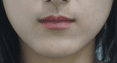 입술필러잘하는곳 찾고 있는데 청담 근처에 있을까요? 1
