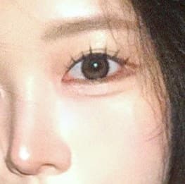 아이울쎄라가격 vs 써마지 효과차이? 1
