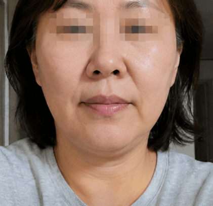 해운대 써마지 아줌마 후기 남편이 다른 사람 됐다네요 ㅋㅋㅋ 1