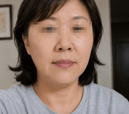 해운대 써마지 아줌마 후기 남편이 다른 사람 됐다네요 ㅋㅋㅋ 2