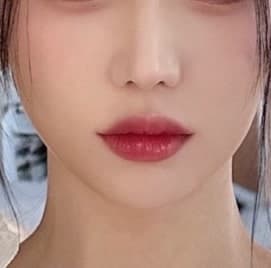얼굴지방이식후기 세이예스의원 40마넌대? 2